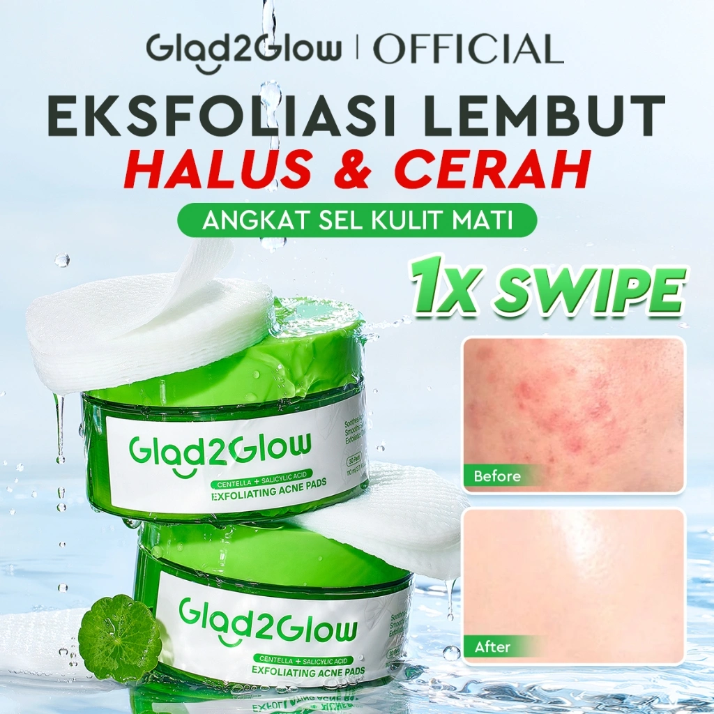 Glad2Glow Centella Salicylic Acid Exfoliating Acne Toner Pads Gentle Eksfoliasi Kulit Jerawat Kulit Sensitif Centella Pads Lactic Acid Malic AHA BHA Peeling Serum Acne Spot Serum Cica Acne Clear Pad Treatment Jerawat Acne Mask Glad2Glow Official Store