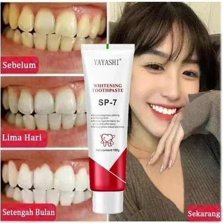 COD Pasta Pemutih Gigi Probiotik SP-7 100gr Whitening toothpaste Odol Pemutih Gigi Kuning, Penghilang dan pembersih Karang Gigi, Pasta Pemutih Gigi Ampuh Permanen pemutih gigi kuning pasta gigi murah