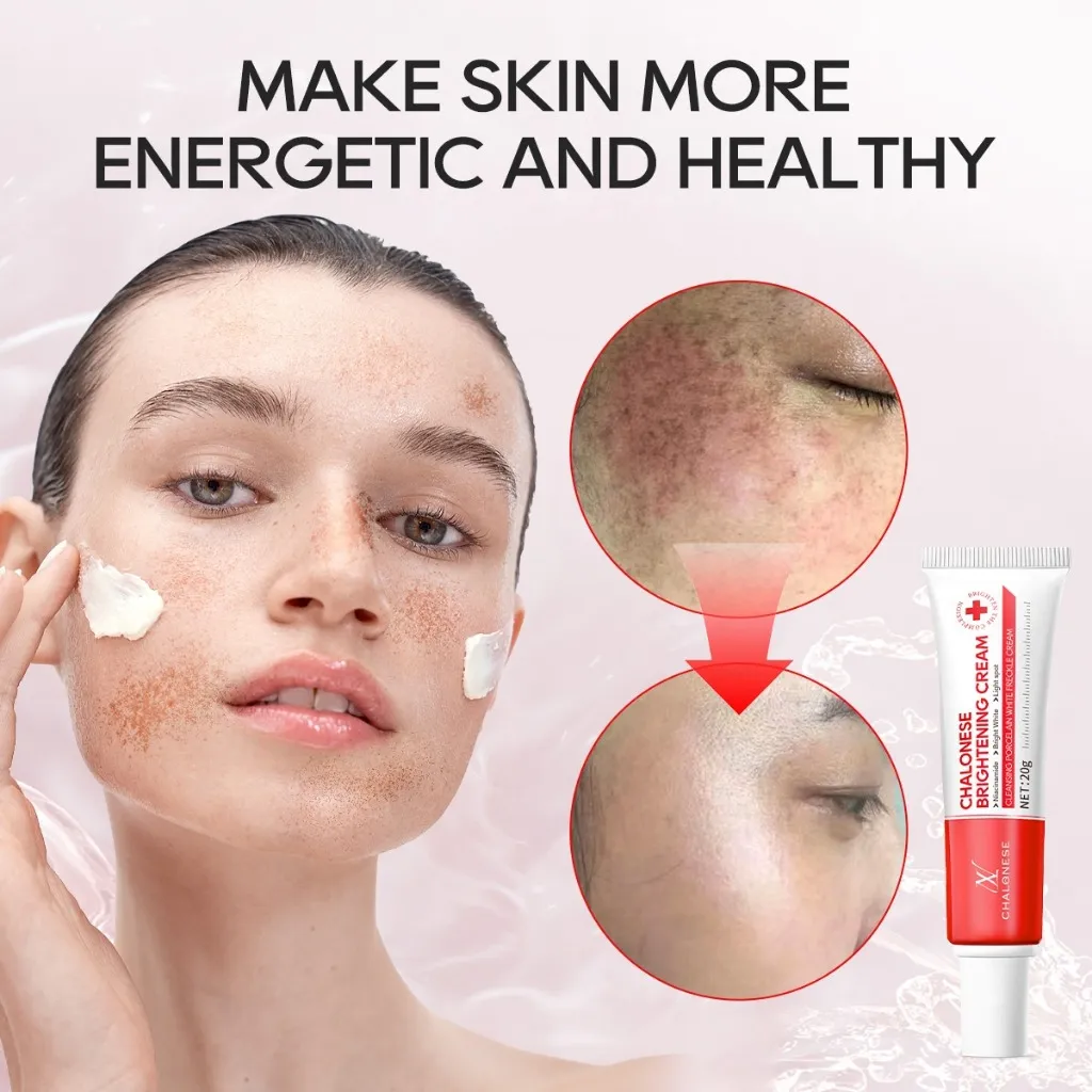 [CHALONESE] 3PCS BRIGHTENING AND WHITENING CREAM 20gr Memudarkan Flek Hitam di Wajah sehingga Membuat Wajah Lebih Cerah BPOM COD mencerahkan menutrisi melembabkan wajah anti darkspot krim halal menyamarkan bekas jerawat