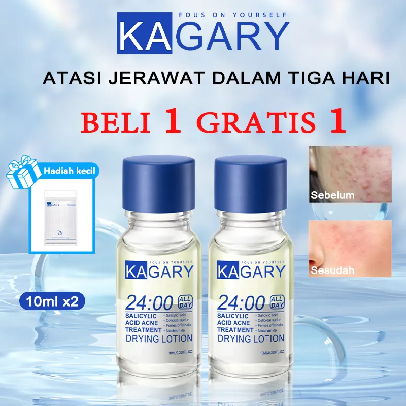 Beli 1 gratis 1 KAGARY Salicylic Acid Acne Drying Lotion 10mL Niacinamide Memudarkan Acne Spot