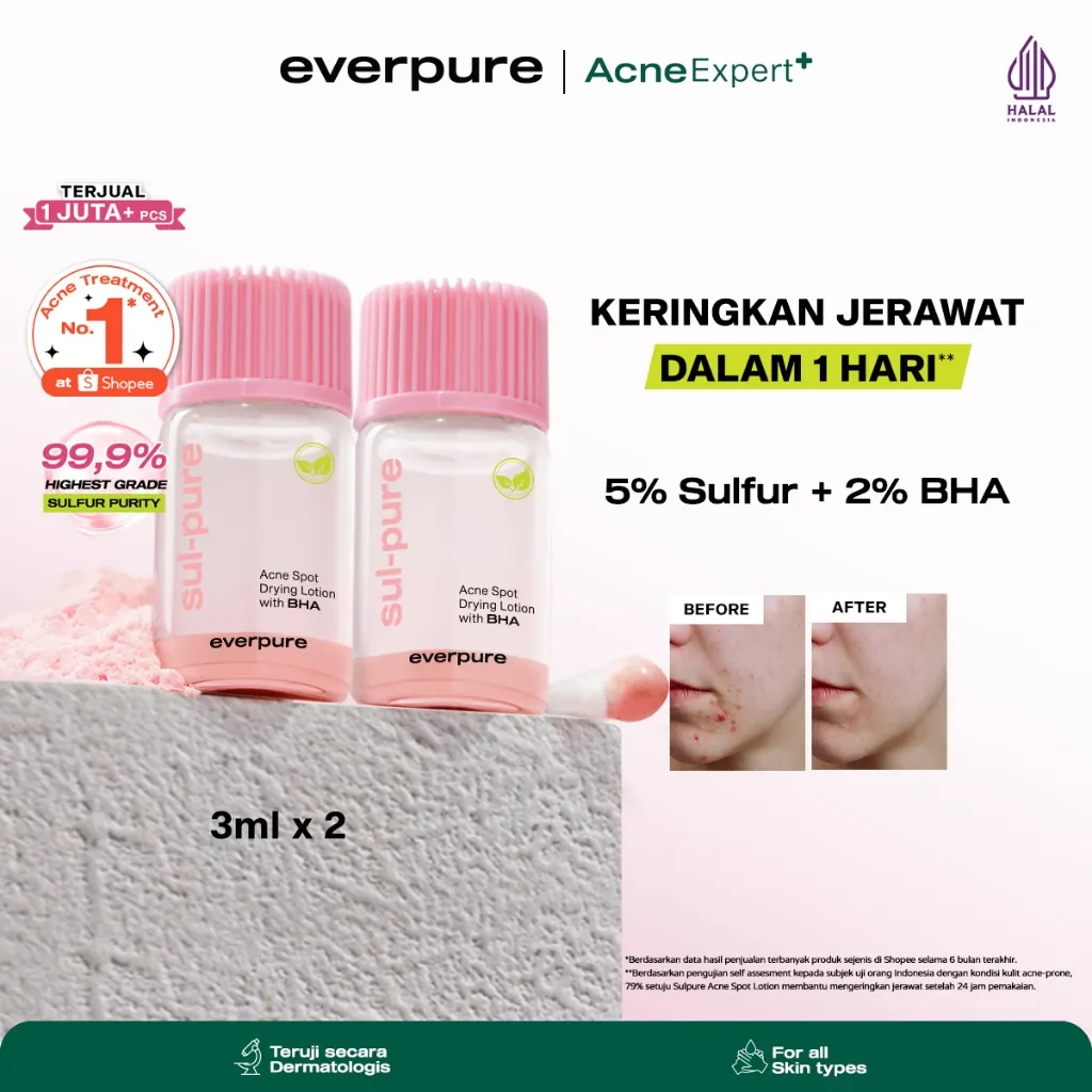 TWINPACK 3ML EVERPURE  SUL-PURE ACNE SPOT DRYING LOTION (with BHA) - OBAT TOTOL MENGERINGKAN JERAWAT DALAM 1 HARI DENGAN SULFUR & BHA [BPOM]