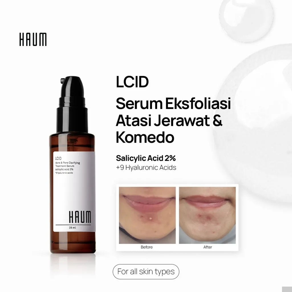 HAUM LCID Serum Salicylic Acid 2% + 9 Hyaluronic Acids | Serum Eksfoliasi & Anti Jerawat - 28 mL