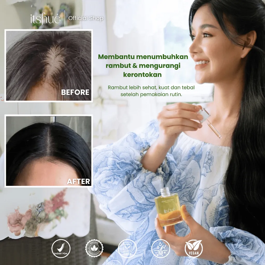ITSHUE Hair Treatment Oil 50ml | Perawatan Rambut Rontok, Hair Growth Oil, Anti Frizz
