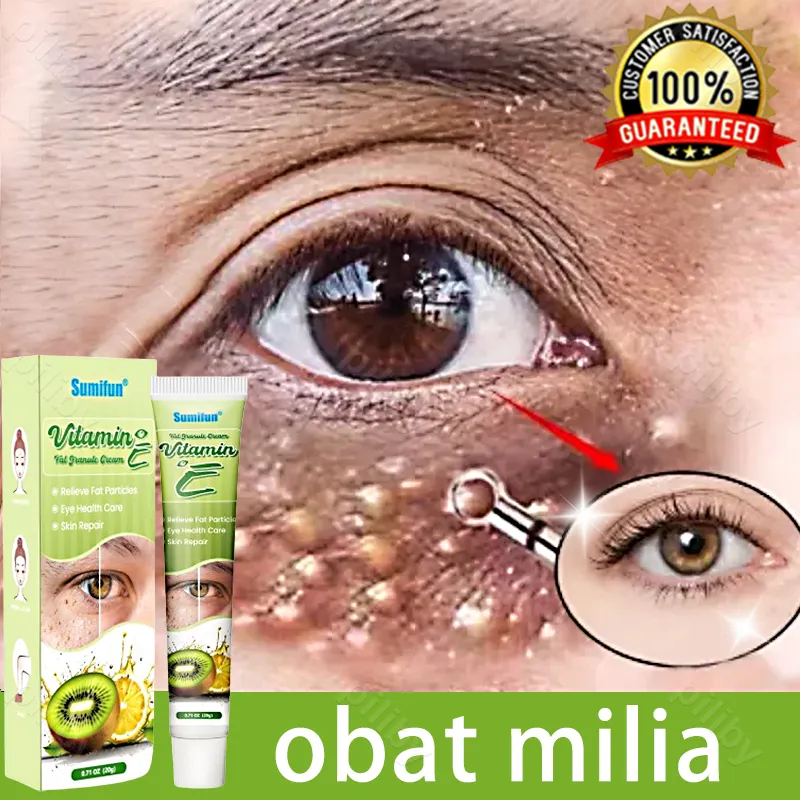 Krim Penghilang Milia Paling Ampuh Eye Cream Milia Remover Obat Milia Di Bawah Mata Krim Milia Menghilangkan Milia Syringoma Xanthelasma Butiran Lemak Sekitar Mata