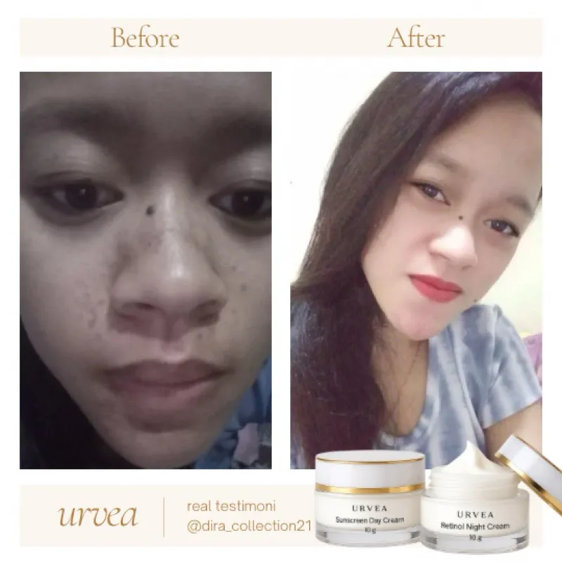 KYZA X URVEA RETINOL CREAM [Exclusive Launch]