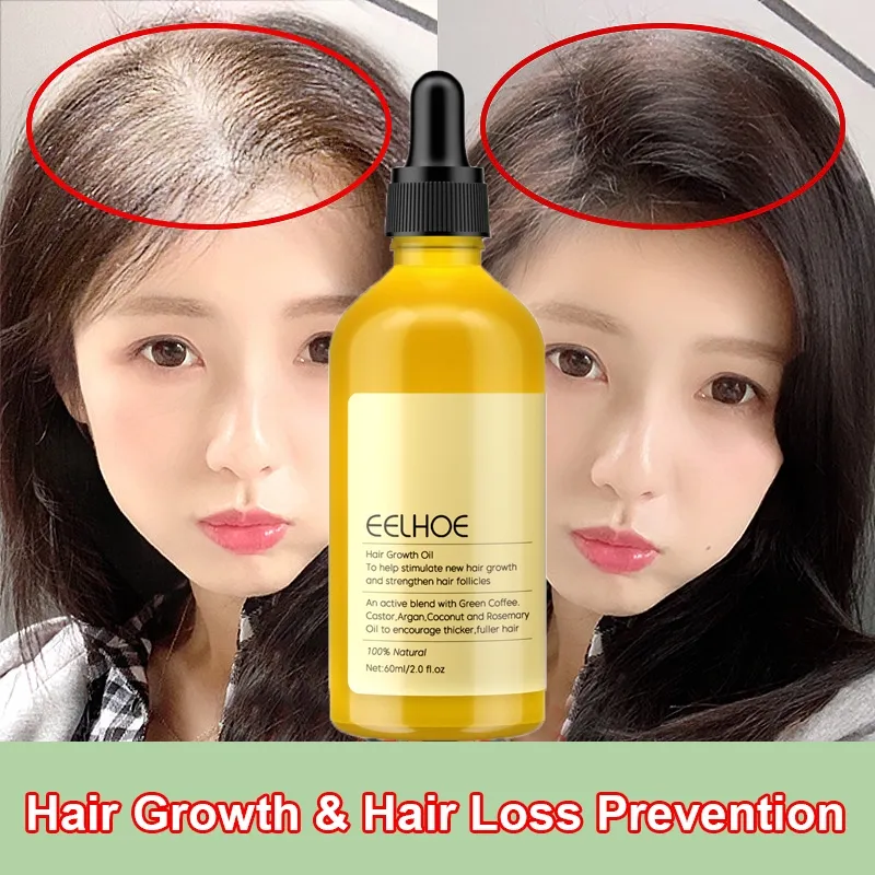 rosemary oil untuk rambut penumbuh rambut serum penumbuh rambut hair serum rambut rontok Hair Growth vitamin penumbuh rambut hair tonic