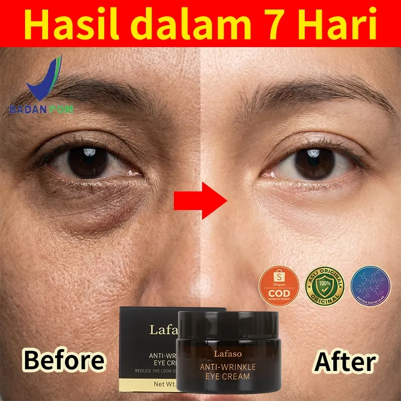 LAFASO Eye Cream Krim Mata Panda & Kerutan - Solusi Kantung Mata Hitam & Garis Halus BPOM Original