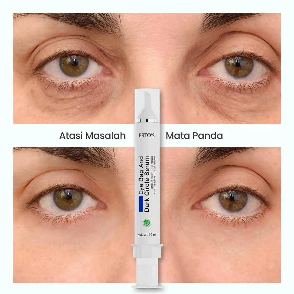 Ertos Eyebag &Dark Circle Serum/serum mata/perawatan mata/eye serum/eye cream/kantong mata/treatment