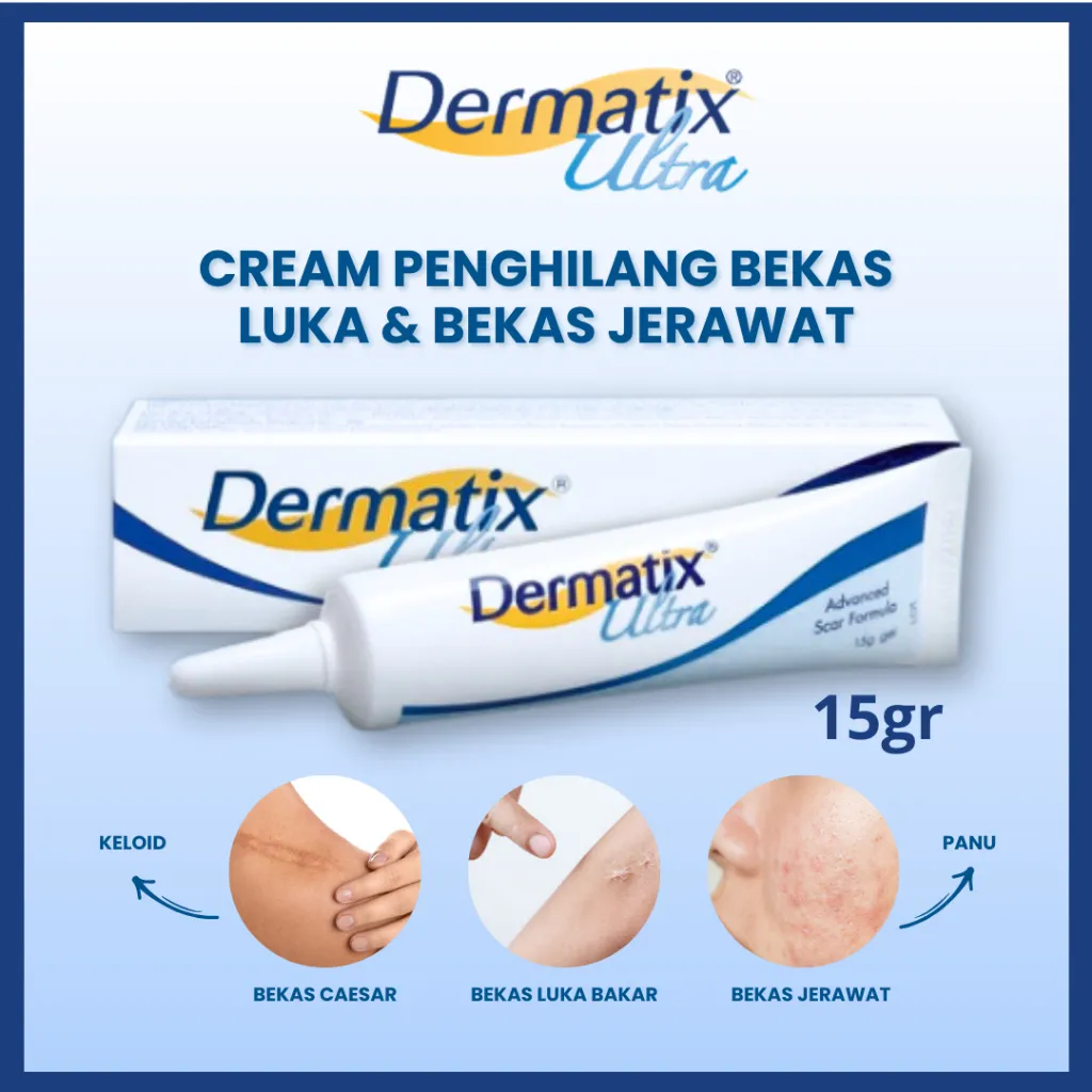 Dermatix Ultra 15gr Cream Penghilang Bekas Luka, Bekas Jerawat