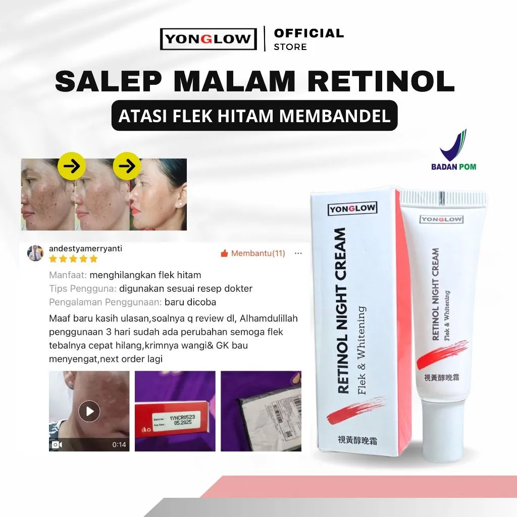 Yonglow Salep Flek Malam Retinol Bintik Noda Hitam Membandel BPOM Night Whitening Cream Flek Penghilang Noda Hitam Bekas Jerawat Melasma Membandel