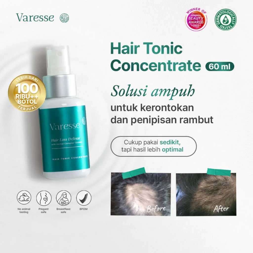 Varesse Hair Tonic Concentrate 60 ml - Membantu Mengurangi Kerontokan, Mempercepat Pertumbuhan, Menutrisi Rambut