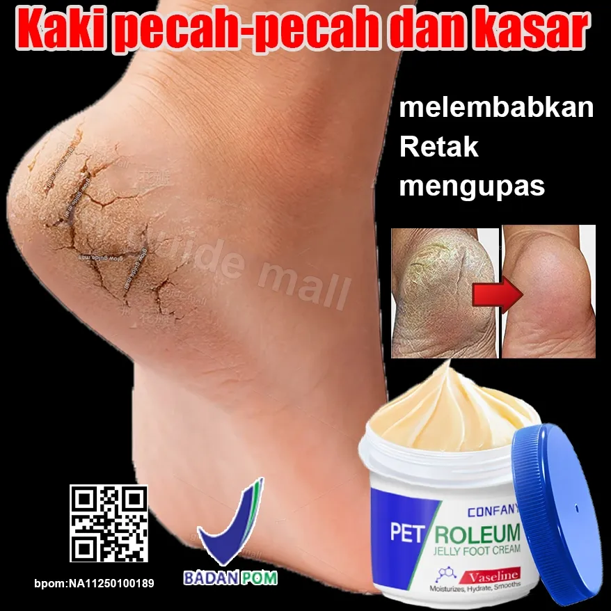 cream kaki pecah dan kering krim kaki foot cream krim kaki obat kaki pecah pecah kaki pecah dan kering