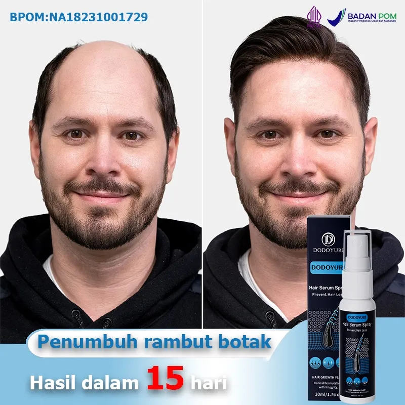 Serum penumbuh rambut Penumbuh rambut botak Hair tonic rambut rontok 30ml Penumbuh rambut cepat Serum rambut rontok Vitamin rambut Obat penumbuh rambut Hair tonic penumbuh rambut Obat rambut rontok Hair growth serum