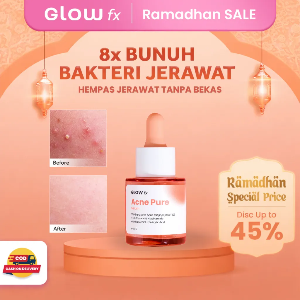 GLOW fx BEAUTY Acne Pure Serum 20mL