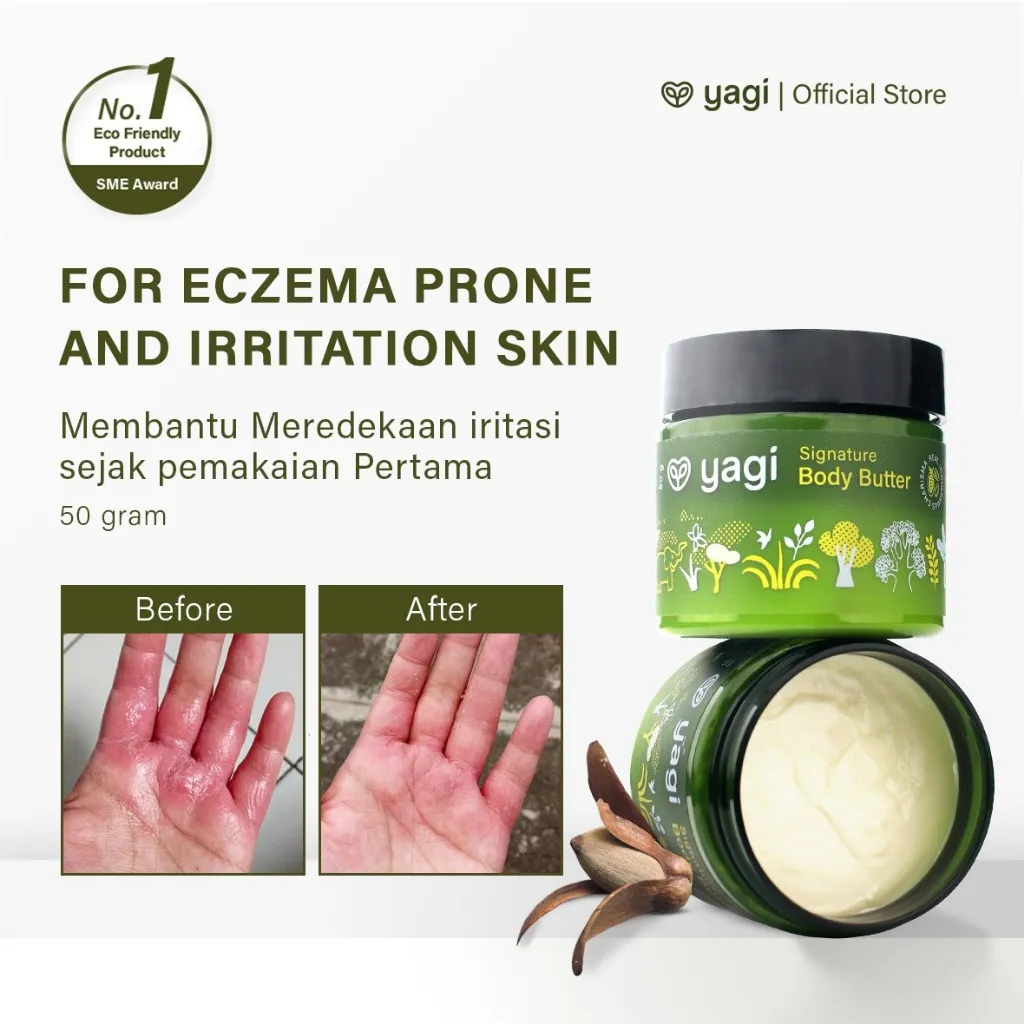 YAGI Forest-Signature Body Butter | Eczema Body Butter