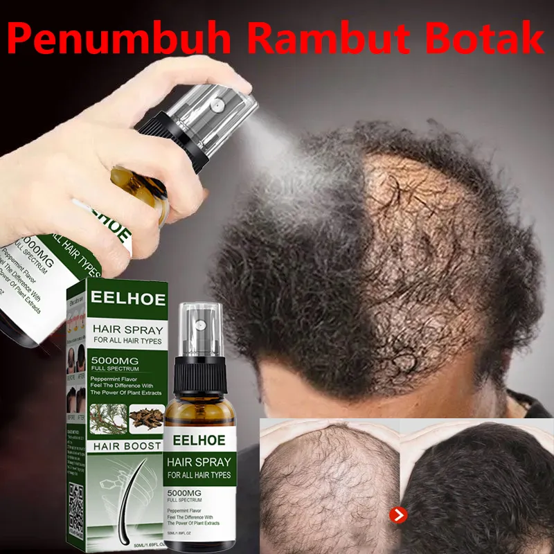 Penumbuh Rambut Botak Semprotan Penumbuh Rambut Obat Rambut Botak Serum Penumbuh Rambut Hair Growth Serum Penebal Rambut Penumbuh Rambut Cepat Dan Tebal Hair Tonic Anti Rontok