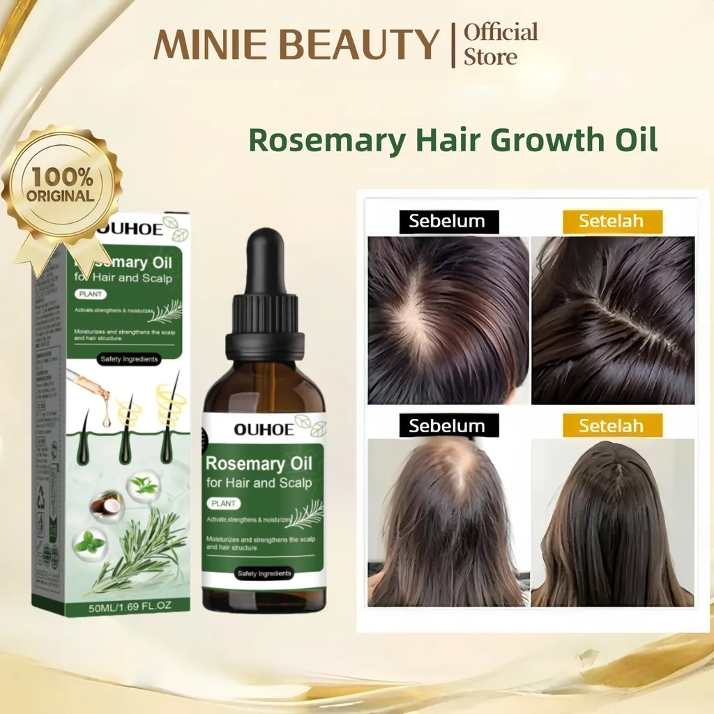 MINNIE BEAUTY 50ml Rosemary Oil penumbuh rambut pelebat rambut penumbuh rambut botak penumbuh rambut botak tebal serum rambut rontok Hair growth serum