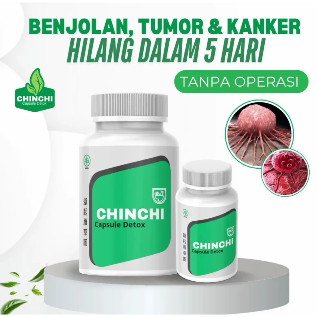 SUPLEMEN CHINCHI BENJOLAN KANKER / HERBAL CHINA PENGEMPES BENJOLAN / OBAT BENJOLAN TERBAIK