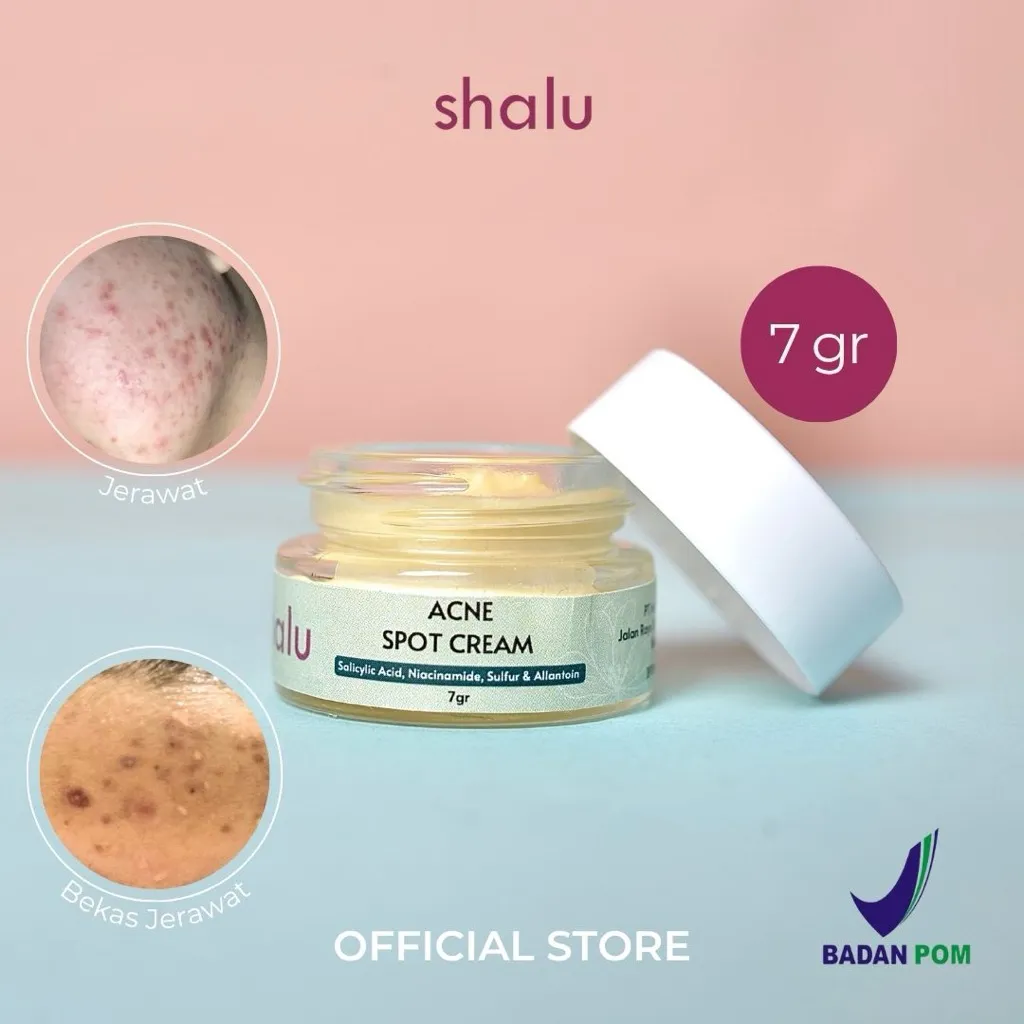 SHALU Acne Spot Cream 7g BPOM | Salep Cream Totol Jerawat Shalu Beauty Atasi untuk Jerawat, Beruntusan dan Memudarkan Bekas Jerawat PIE PIH [BPOM]