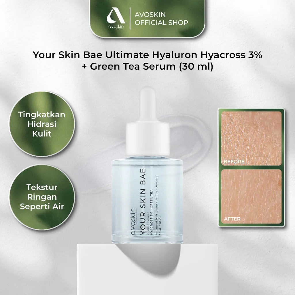 Serum Avoskin Your Skin Bae Hyacross 30ml-Menghidrasi Kulit Kering