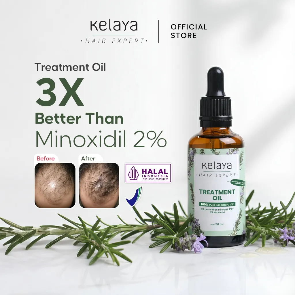 Kelaya Hair Expert Rosemary Oil 50ml 3X Lebih Ampuh Dari Minoxidil Penumbuh Rambut Rontok & Kering