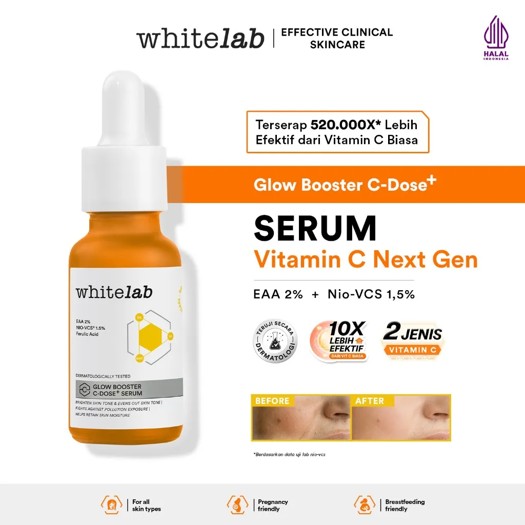 Whitelab Serum Vitamin C Glow Booster - Antioksidan Tinggi untuk Kulit Cerah dan Glowing C-Dose+ dengan NIO-VCS