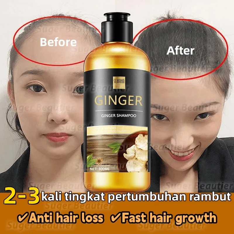 Shampo Penumbuh Rambut Cepat Ginger Shampoo 300ml pertumbuhan rambut Pengendalian Minyak Anti rambut rontok Botak shampo penumbuh rambut sampo anti ketombe dan rontok Anti Hair Fall Hair Treatment Shampoo Mengurangi Rambut Rontok