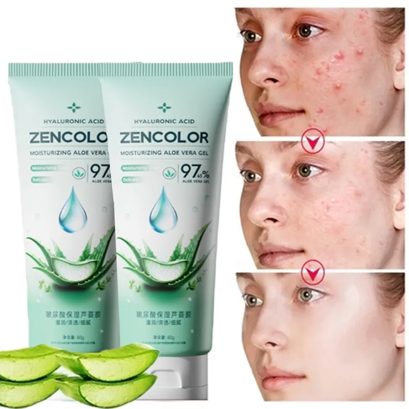【Hadiah gratis】aloe vera gel Repair Skin bekas jerawat Pelembab gel lidah buaya lidah buaya gel untuk wajah moisturizer lidah buaya