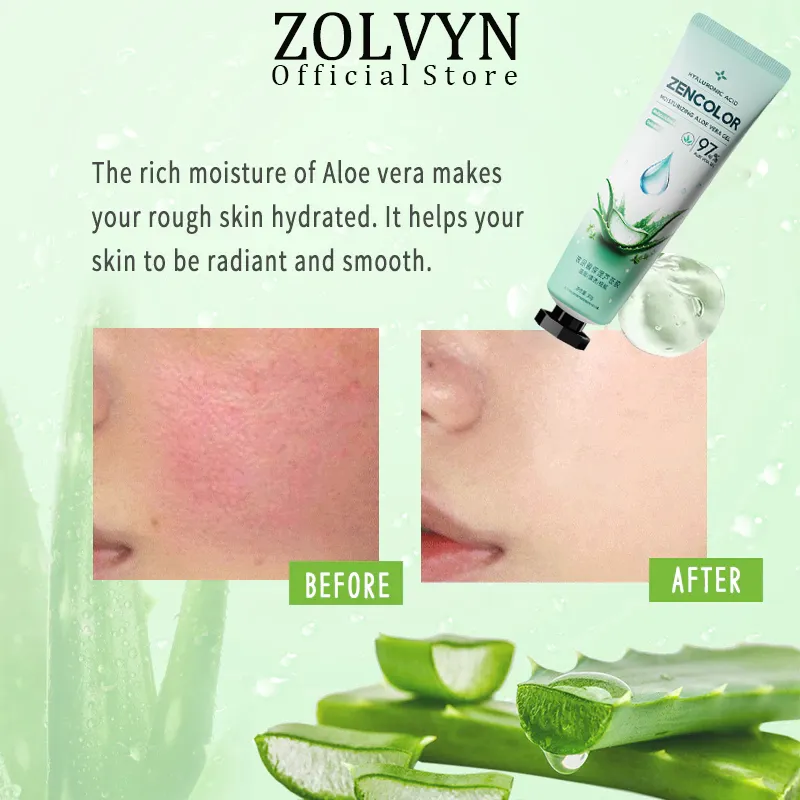 ZOLVYN Aloe Vera Gel Pelembab Anti-Penuaan Kerut Jerawat Jerawat Bintik Hitam Korektor Krim Wajah Pemutih Tubuh Membakar Kulit /Terbakar Perbaikan / Lidah Buaya / Melembabkan Dan Melembabkan