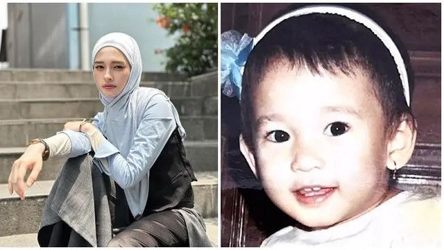 6 Potret Masa Kecil Inara Rusli, Sudah Glowing Sejak Dini Tepis Tudingan Suntik Pemutih Kulit