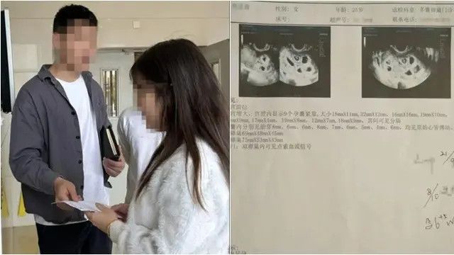 Awalnya Didiagnosis Punya 3 Bayi dalam Kandungannya, tapi Wanita Ini Terkejut saat Cek ke Dokter Lagi