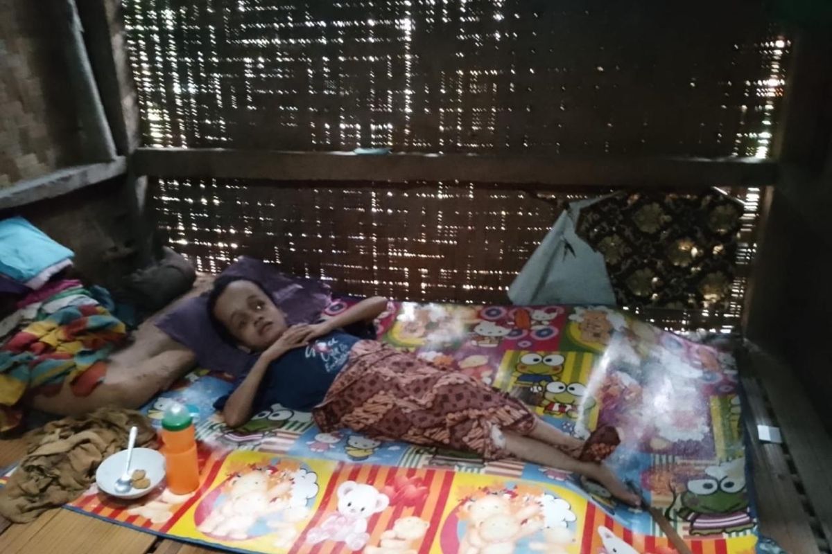 Ani, Gadis Penderita Hidrosefalus Butuh Bantuan Donatur