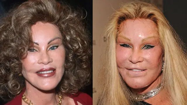 Jocelyn Wildenstein 'Catwoman', Sosialita Asal Swiss Sekaligus Penggila Operasi Plastik Dikabarkan Meninggal Dunia