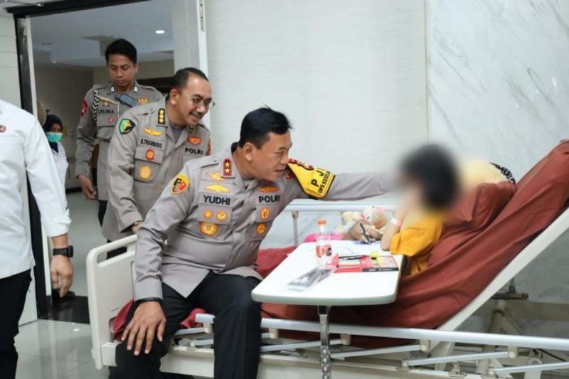 Kapolda Sulsel Jenguk Korban Kekerasan Anak di Makassar