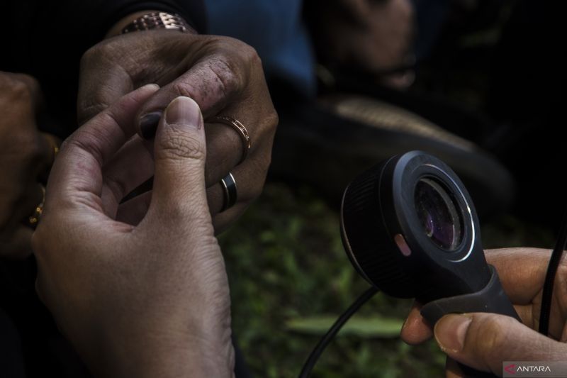 Gejala Penyakit Autoimun Bisa Ditekan, Pola Hidup Sehat Jadi Kunci