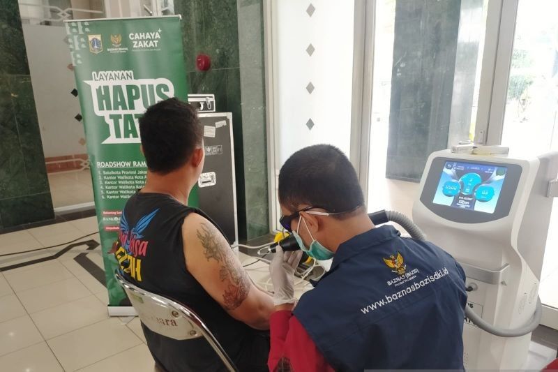 134 Warga Jakbar Hapus Tato Gratis, Alasannya Beragam!