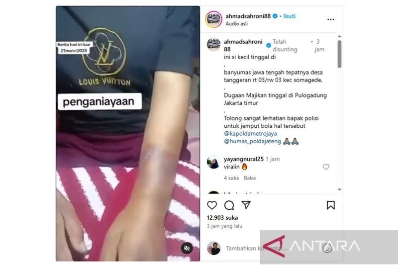 ART Asal Banyumas Diduga Dianiaya di Jakarta, Polisi Selidiki Kasus Viral