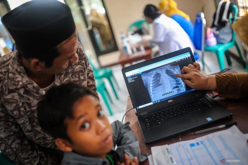 Butuh Vaksin TB Baru? Pakar Sebut BCG Sudah Usang!