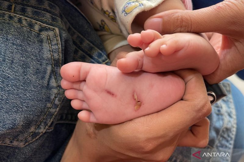Ayah Aniaya Bayi 2 Bulan di Lombok Barat, Polisi Amankan Pelaku