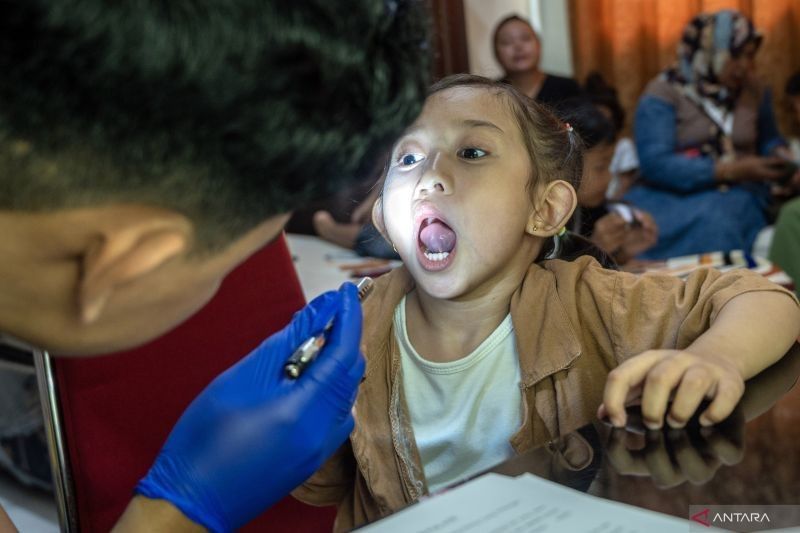 Bibir Sumbing? Bedah Plastik Tawarkan Solusi untuk Pertumbuhan Normal Anak