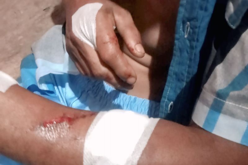 Waspada! BPBD Tanjungpinang Imbau Masyarakat Pesisir Tingkatkan Kewaspadaan Terhadap Serangan Buaya