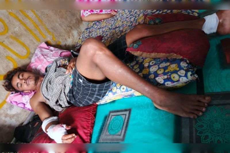 Fakta Unik: Beruang Madu Serang Pekerja Sawit di Kotim, Diduga Terganggu Saat Tidur Siang