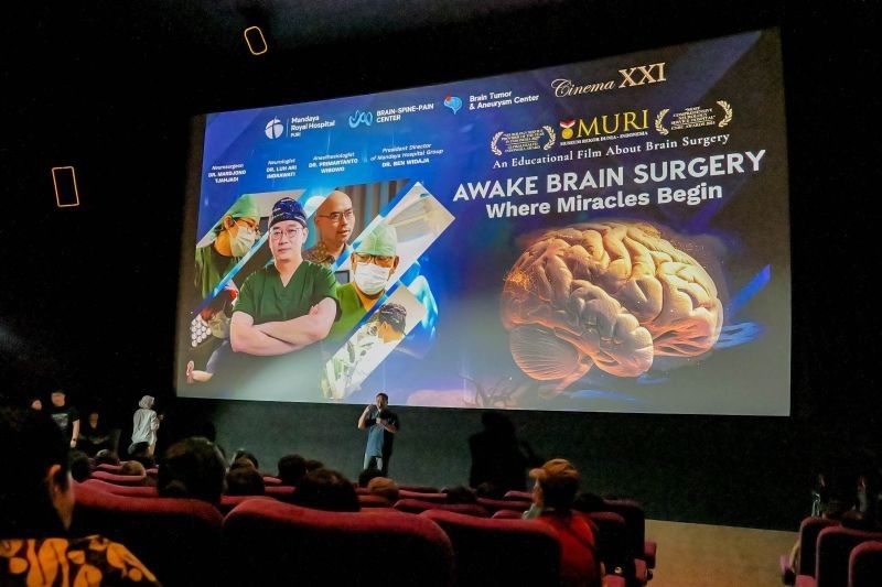 MURI Rekor! RS Mandaya Ungkap Keajaiban Operasi Tumor Otak Lewat Film Dokumenter 'Awake Brain Surgery'