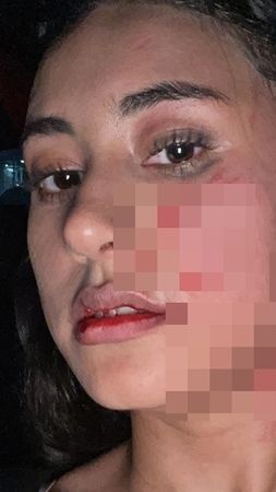 Potret Selebgram Afifah Riyad yang Kini Jadi Sorotan Karena Alami Kekerasan dari Mantan Pacar Suami