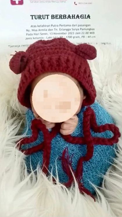 Bayi Prematur  1,5 Kg Diduga Meninggal Usai Pemotretan ‘Newborn’ untuk Konten Klinik, Kasusnya Viral