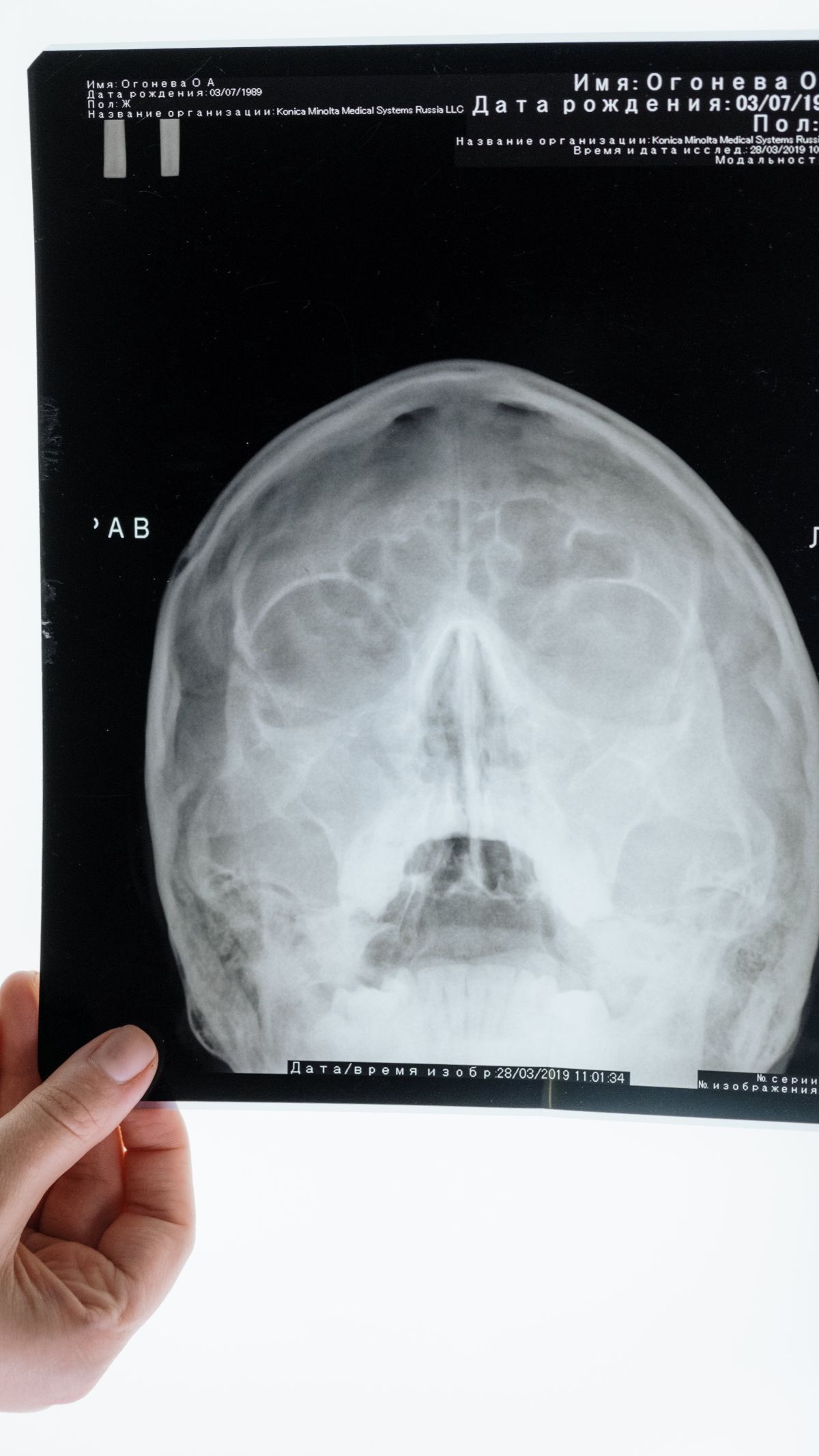 Peristiwa 8 November: Peringatan Hari Radiologi Internasional, Ini Sejarahnya