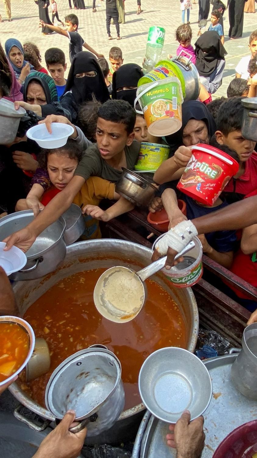 Anak-Anak Gaza Konferensi Pers di Rumah Sakit, 