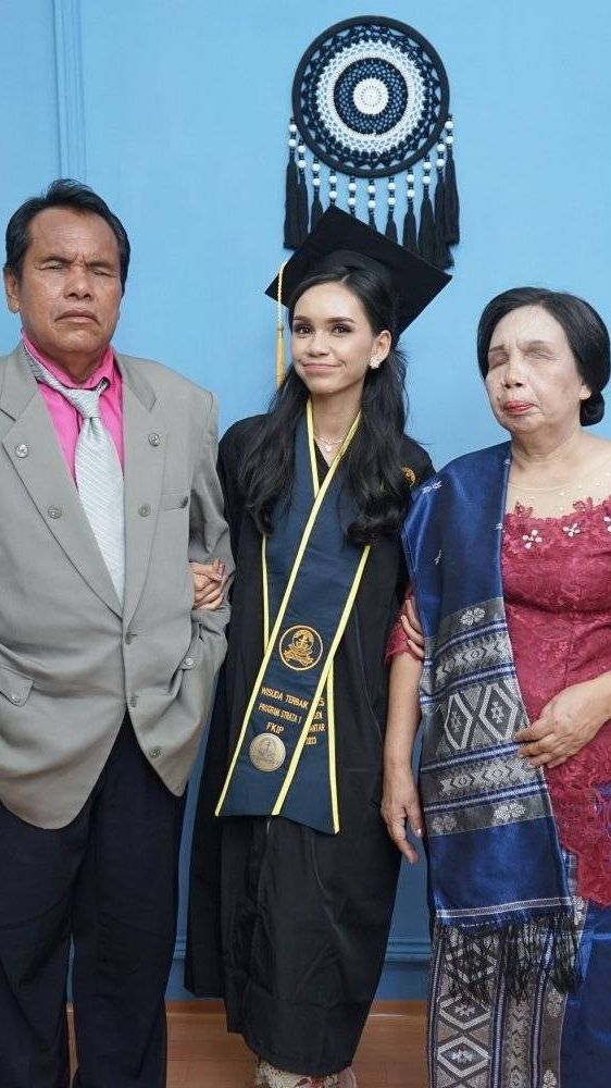 Kisah Septiani Hirawati jadi Mahasiswi Terbaik Lulus Cumlaude, Ibu Bapaknya Tunanetra Hadiri Wisuda Begitu Bangga