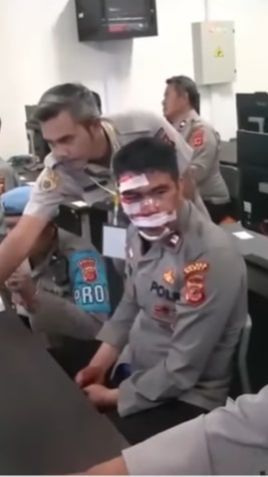 Muka Bonyok Penuh Luka dan Perban, Bintara Polri ini Gigih Ikut Tes Perwira, Hasilnya di Luar Dugaan