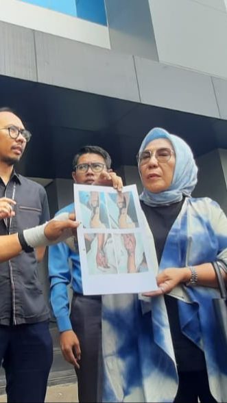 Diduga Jadi Korban Malpraktik, Tangan Pria Ini Membusuk Usai Diinfus